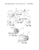 METHODS AND APPARATUS FOR PERFORMING KNEE ARTHROPLASTY diagram and image