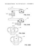 METHODS AND APPARATUS FOR PERFORMING KNEE ARTHROPLASTY diagram and image