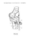 METHODS AND APPARATUS FOR PERFORMING KNEE ARTHROPLASTY diagram and image