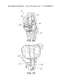 METHODS AND APPARATUS FOR PERFORMING KNEE ARTHROPLASTY diagram and image