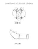 METHODS AND APPARATUS FOR PERFORMING KNEE ARTHROPLASTY diagram and image