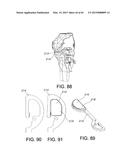 METHODS AND APPARATUS FOR PERFORMING KNEE ARTHROPLASTY diagram and image