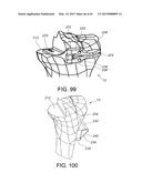 METHODS AND APPARATUS FOR PERFORMING KNEE ARTHROPLASTY diagram and image