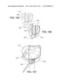 METHODS AND APPARATUS FOR PERFORMING KNEE ARTHROPLASTY diagram and image