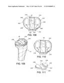 METHODS AND APPARATUS FOR PERFORMING KNEE ARTHROPLASTY diagram and image