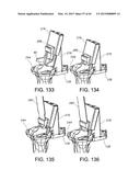 METHODS AND APPARATUS FOR PERFORMING KNEE ARTHROPLASTY diagram and image