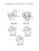 METHODS AND APPARATUS FOR PERFORMING KNEE ARTHROPLASTY diagram and image