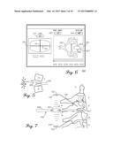 DEVICE AND METHOD FOR ENABLING AN ORTHOPEDIC TOOL FOR PARAMETER     MEASUREMENT diagram and image