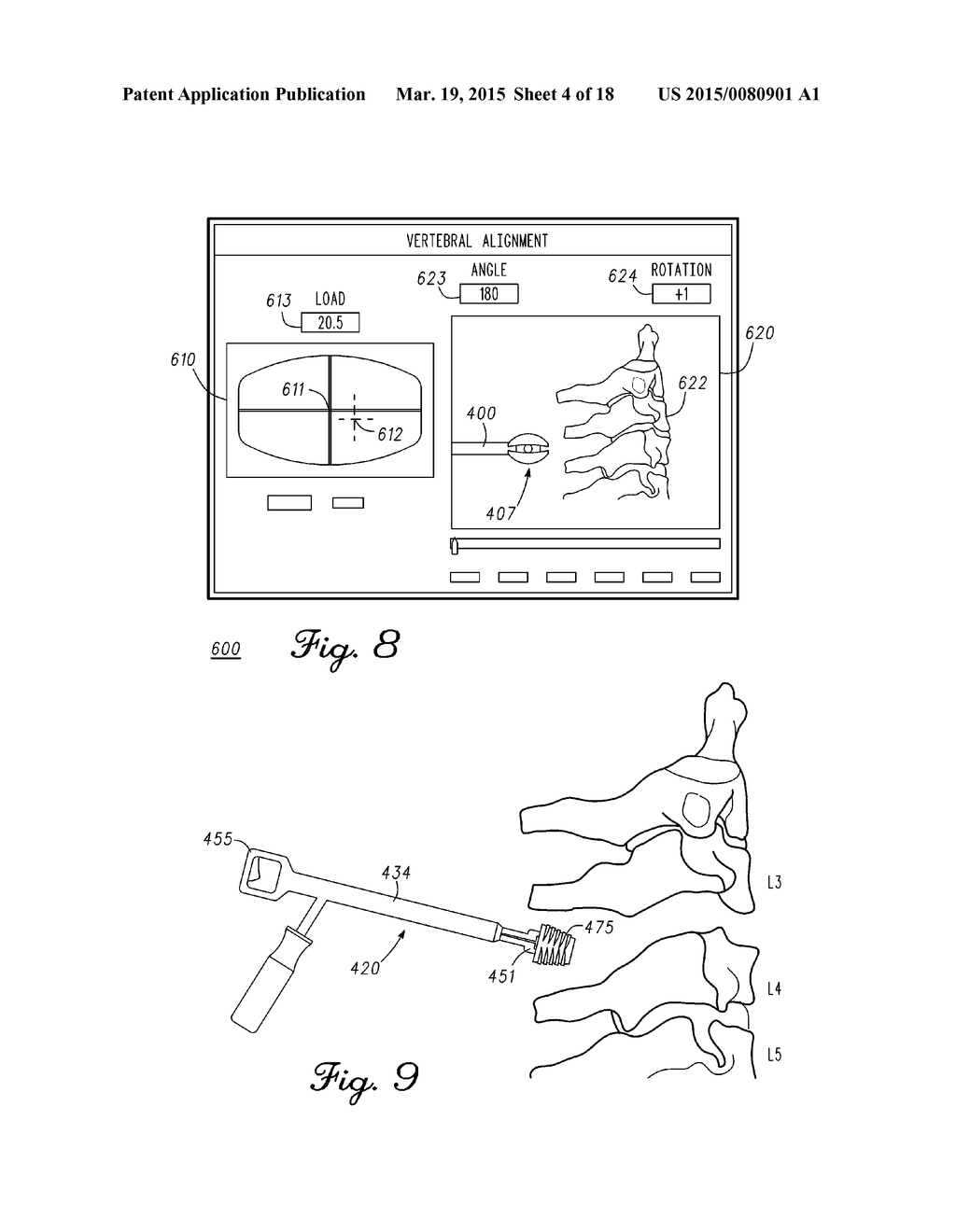 DEVICE AND METHOD FOR ENABLING AN ORTHOPEDIC TOOL FOR PARAMETER     MEASUREMENT - diagram, schematic, and image 05