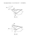 Method and System for Hand Presence Detection in a Minimally Invasive     Surgical System diagram and image