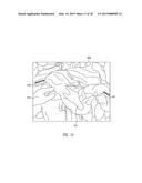 Method and System for Hand Presence Detection in a Minimally Invasive     Surgical System diagram and image