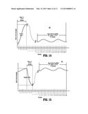 APPARATUS AND METHOD FOR DIFFERENTIATING BETWEEN TISSUE AND MECHANICAL     OBSTRUCTION IN A SURGICAL INSTRUMENT diagram and image