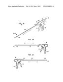 SURGICAL FASTENERS FOR SECURING PROSTHETIC DEVICES TO TISSUE diagram and image