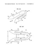 SURGICAL FASTENERS FOR SECURING PROSTHETIC DEVICES TO TISSUE diagram and image