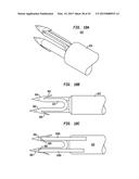 SURGICAL FASTENERS FOR SECURING PROSTHETIC DEVICES TO TISSUE diagram and image