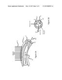 System and Methods Which Remove Material From Blood Vessel Walls diagram and image