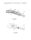 ARTICULATION FEATURES FOR ULTRASONIC SURGICAL INSTRUMENT diagram and image