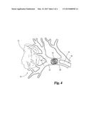 ANTI-TUMOR MACROPHAGE M1 MORPHOLOGY INDUCER diagram and image