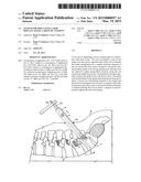 SYSTEM FOR IMPLANTING A ROD IMPLANT ALONG A SPINE OF A PATIENT diagram and image