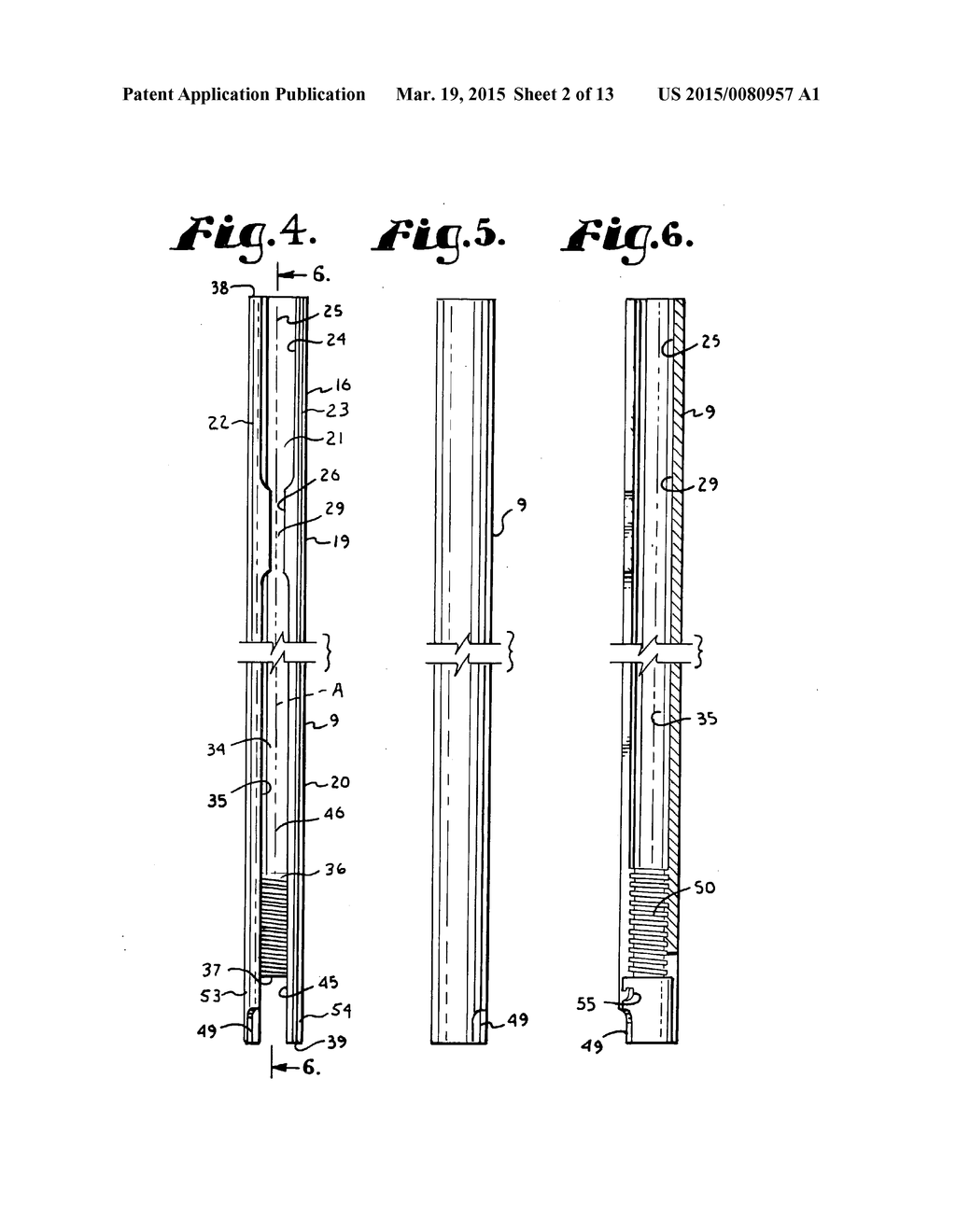 SYSTEM FOR IMPLANTING A ROD IMPLANT ALONG A SPINE OF A PATIENT - diagram, schematic, and image 03