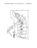 SYSTEM FOR IMPLANTING A ROD IMPLANT ALONG A SPINE OF A PATIENT diagram and image