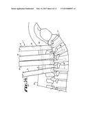SYSTEM FOR IMPLANTING A ROD IMPLANT ALONG A SPINE OF A PATIENT diagram and image