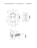 BONE FIXATION SYSTEM INCLUDING K-WIRE COMPRESSION diagram and image