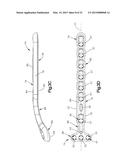 BONE FIXATION SYSTEM INCLUDING K-WIRE COMPRESSION diagram and image