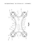 BONE FIXATION SYSTEM INCLUDING K-WIRE COMPRESSION diagram and image