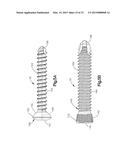 BONE FIXATION SYSTEM INCLUDING K-WIRE COMPRESSION diagram and image