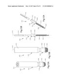 BONE FIXATION SYSTEM INCLUDING K-WIRE COMPRESSION diagram and image