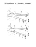 BONE FIXATION SYSTEM INCLUDING K-WIRE COMPRESSION diagram and image