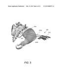 SYSTEM AMD METHOD FOR BONE FUSING IMPLANTS AND IMPLANT INSERTION TOOLS diagram and image