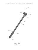 SYSTEM AMD METHOD FOR BONE FUSING IMPLANTS AND IMPLANT INSERTION TOOLS diagram and image