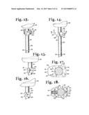 TOOL SYSTEM FOR DYNAMIC SPINAL IMPLANTS diagram and image