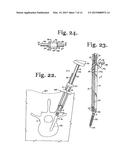 TOOL SYSTEM FOR DYNAMIC SPINAL IMPLANTS diagram and image