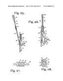 TOOL SYSTEM FOR DYNAMIC SPINAL IMPLANTS diagram and image