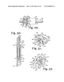 TOOL SYSTEM FOR DYNAMIC SPINAL IMPLANTS diagram and image