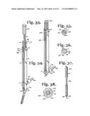 TOOL SYSTEM FOR DYNAMIC SPINAL IMPLANTS diagram and image