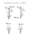 TOOL SYSTEM FOR DYNAMIC SPINAL IMPLANTS diagram and image