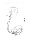 IMPLANTABLE MEDICAL DEVICE TELEMETRY IN DISRUPTIVE ENERGY FIELD diagram and image