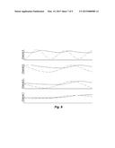 Dynamic Stimulation Channel Selection diagram and image