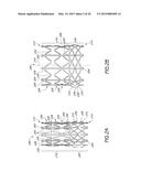 DELIVERY SYSTEM FOR VASCULAR IMPLANT diagram and image