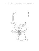 DELIVERY SYSTEM FOR VASCULAR IMPLANT diagram and image