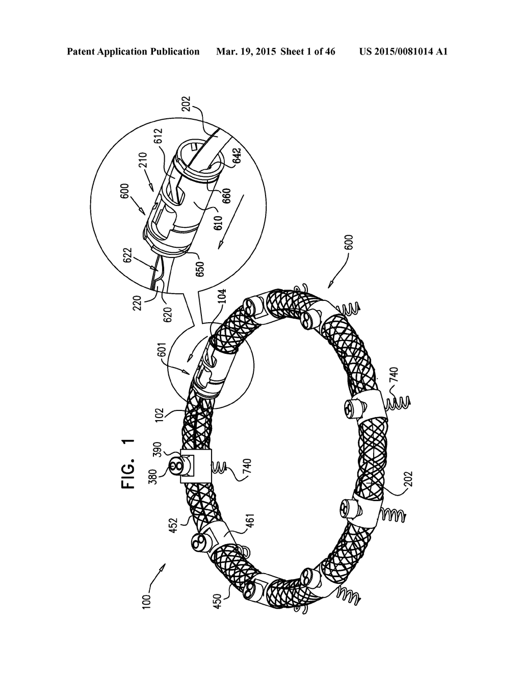 IMPLANT AND ANCHOR PLACEMENT - diagram, schematic, and image 02