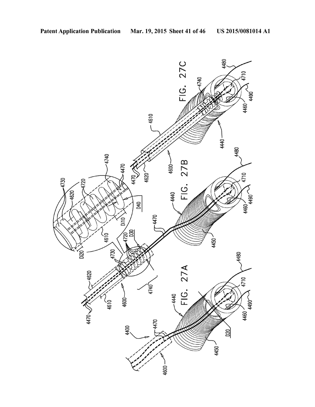 IMPLANT AND ANCHOR PLACEMENT - diagram, schematic, and image 42