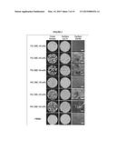 COMBINED SPACE MAINTENANCE AND BONE REGENERATION SYSTEM FOR THE     RECONSTRUCTION OF LARGE OSSEOUS DEFECTS diagram and image