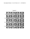 COMBINED SPACE MAINTENANCE AND BONE REGENERATION SYSTEM FOR THE     RECONSTRUCTION OF LARGE OSSEOUS DEFECTS diagram and image