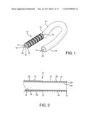 STENTED VASCULAR GRAFT diagram and image