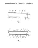 STENTED VASCULAR GRAFT diagram and image